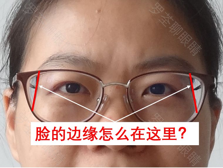 戴近视眼镜后，真的会「变丑」？眼科医生坐不住了