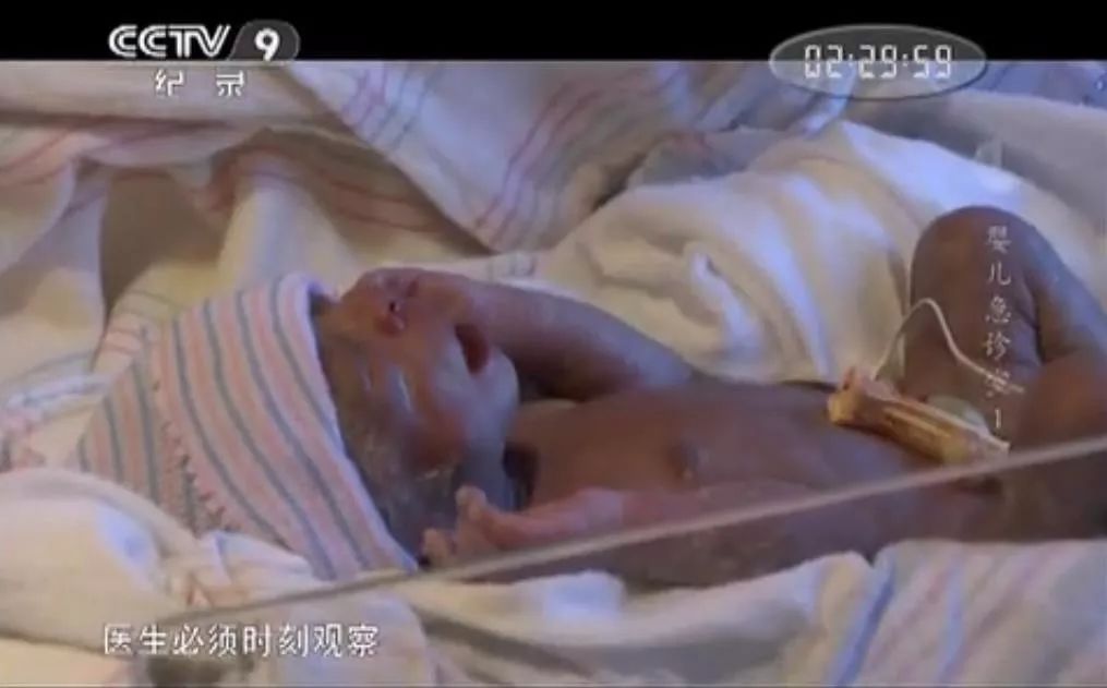 在婴儿急诊室里，一起迎接世界给的第一个考验