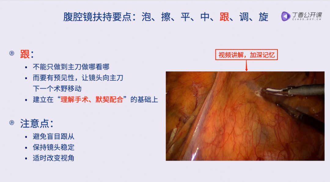 腹腔镜这些「扶镜」「穿刺」......技巧都送你！