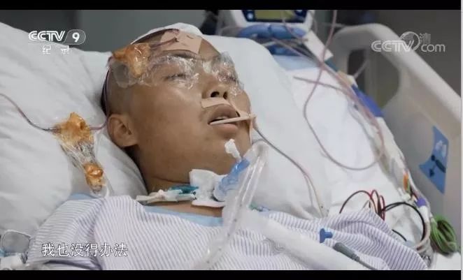 ICU 里的日与夜