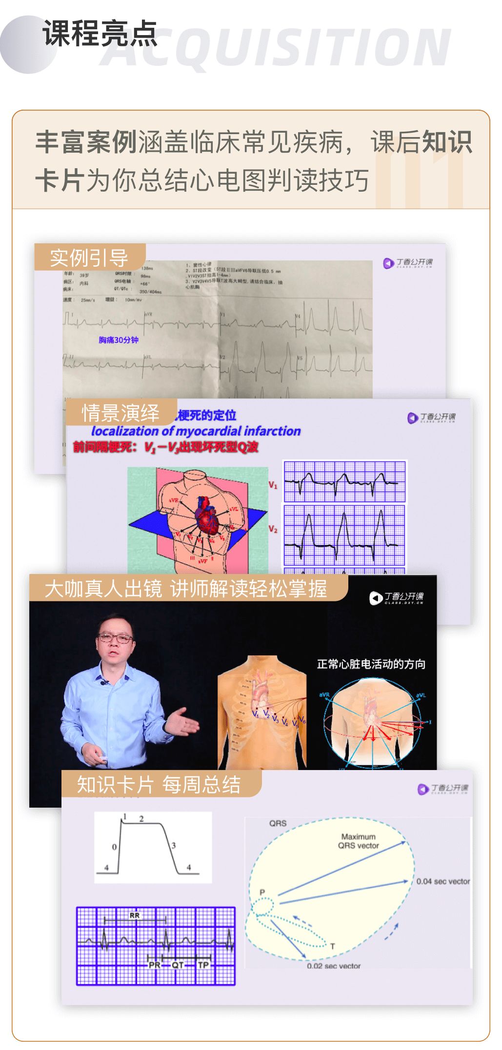 值班遇到「反复胸闷 1 年」,心电图到底怎么看? 值班遇到「反复胸闷 1 年」,心电图到底怎么看?