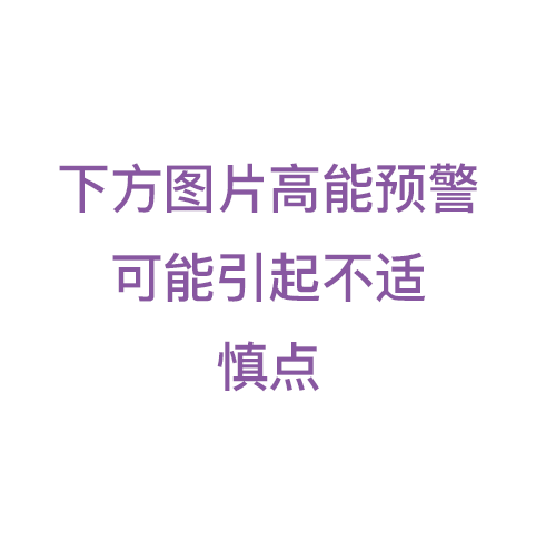 无宫缩，产妇要求终止妊娠，看到孩子后，吓出一身冷汗！