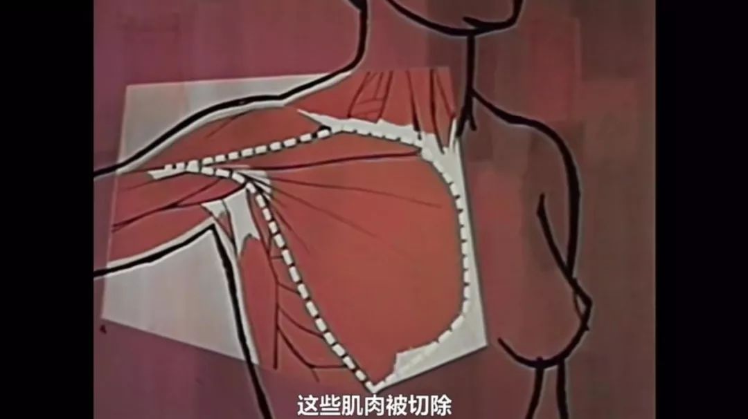 只要活得足够久，人总会患癌
