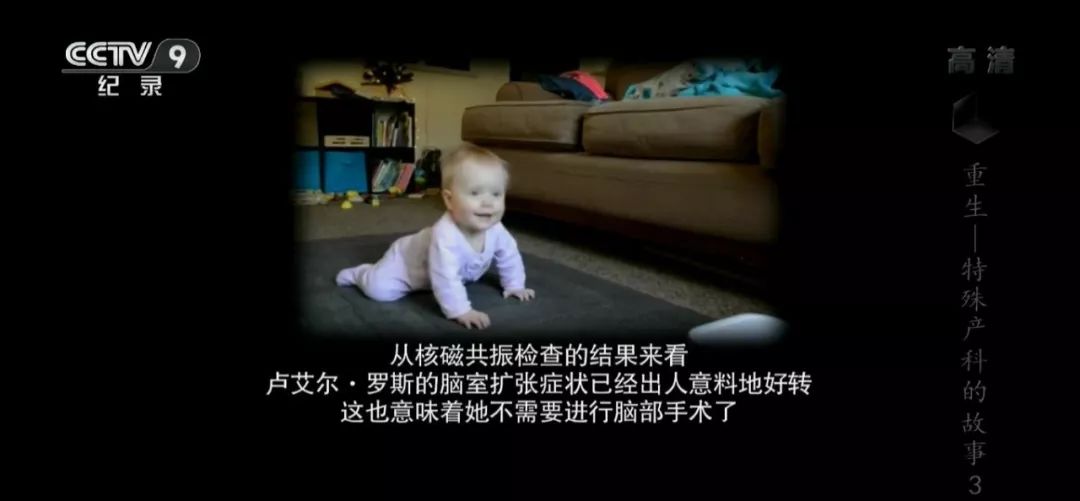 她第一次接受手术，是在妈妈的肚子里