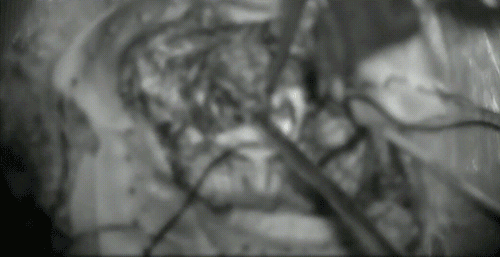 一个直径不足 2 cm 的肿瘤，却令世界上绝大多数医生恐惧