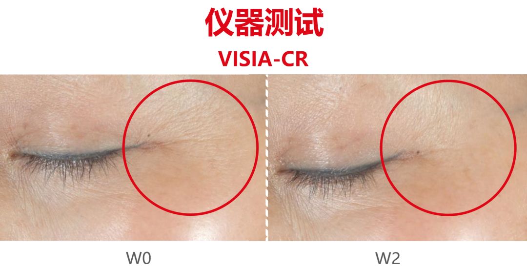 如何科学抵御缺觉、熬夜带来的苍老感？