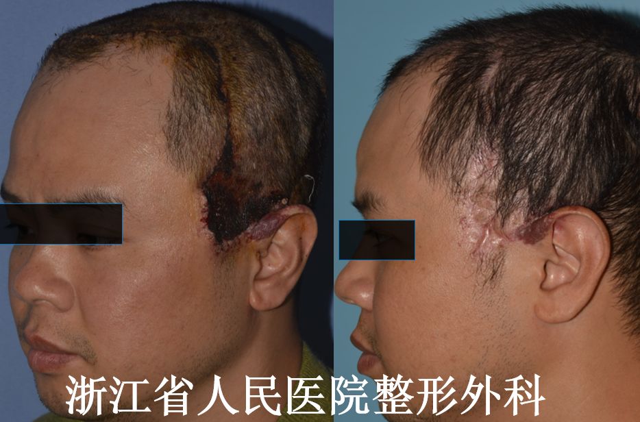 血管瘤：听说最近流行分享病例？这里管够
