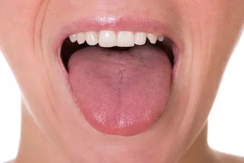丁香病例 | 主诉「伸舌 1 小时」？值班医生一看都笑喷了