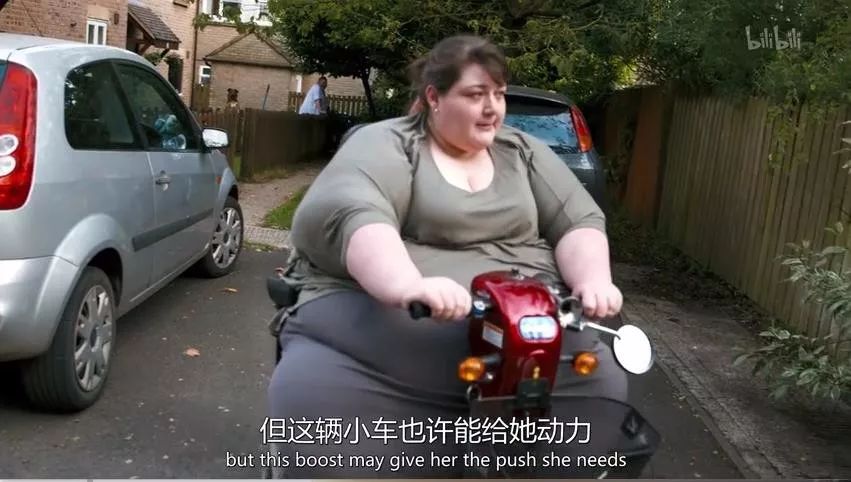为了减肥，她勇敢切掉了 3/4 的胃和 1/3 的小肠