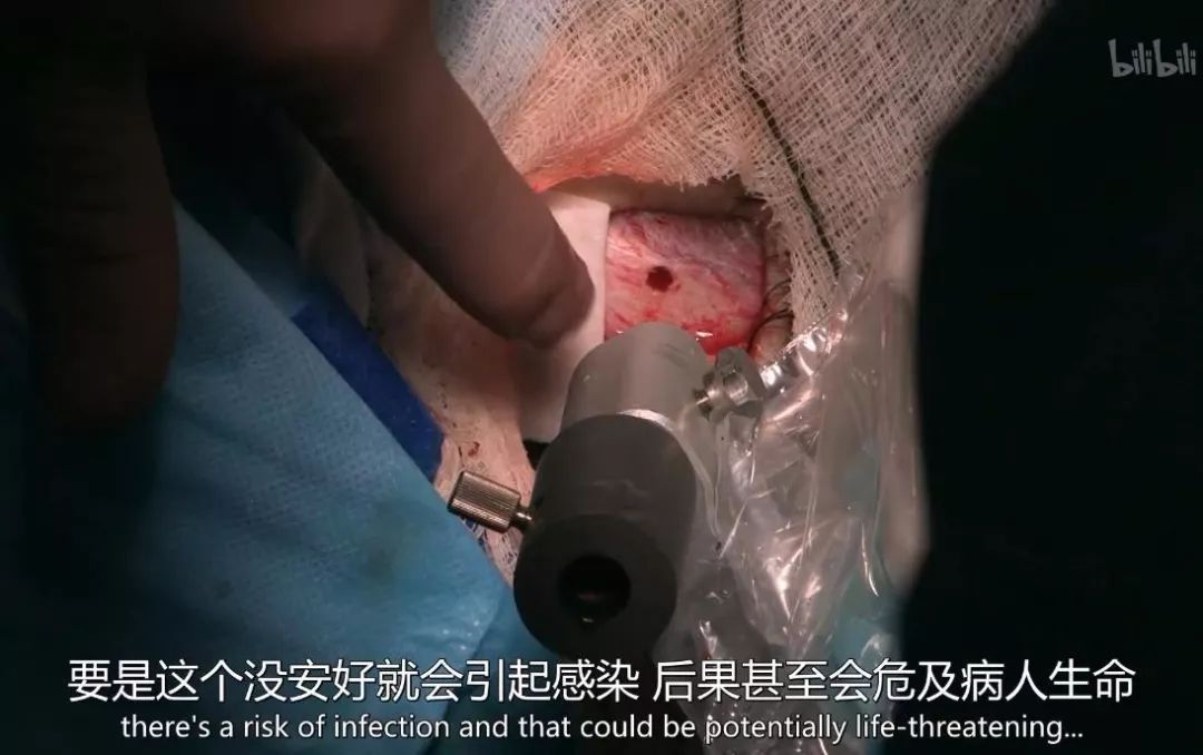历时 6 年，无法站立的他终于可以自由奔跑