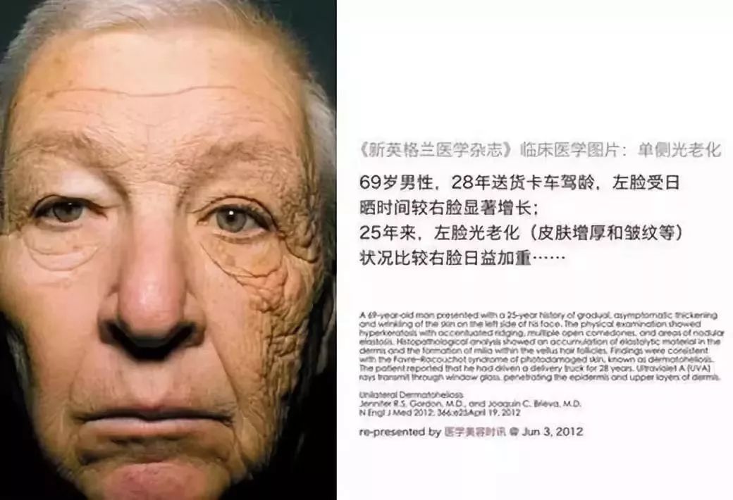 不想变黑又变老，四季都得做好一件事