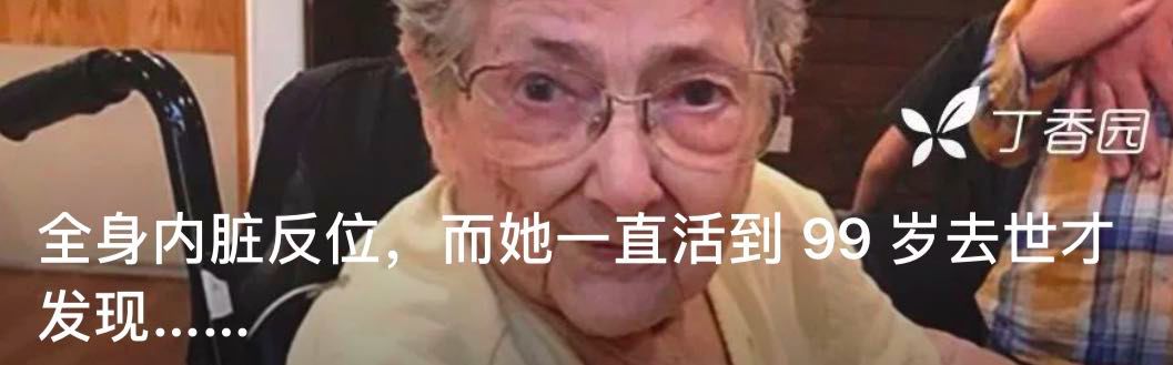 她的双胞胎妹妹，在她的身体里住了 17 年