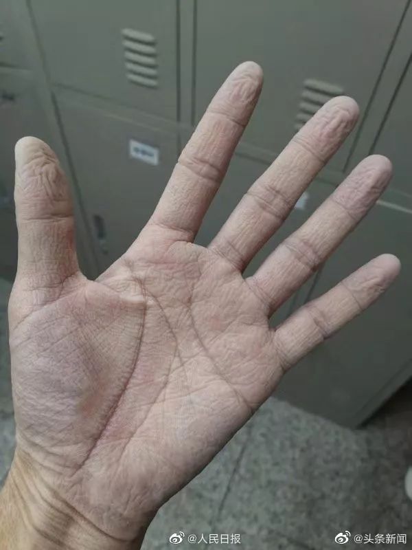 ​疫情一线医生手记：我在发热门诊，值猪年最后一个夜班