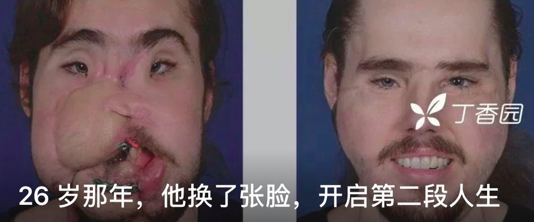 2 岁以前，这对双胞胎从来没见过对方的样子