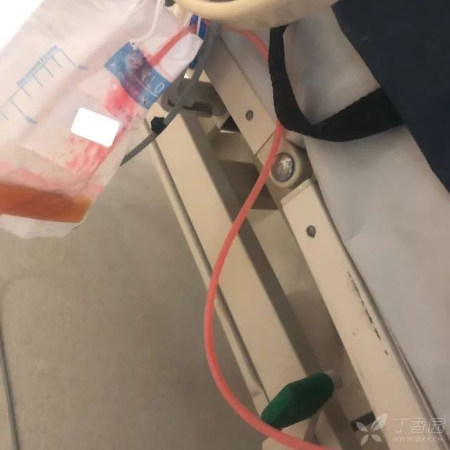 丁香病例 | 患者出现粉色尿液，你的考虑是什么？