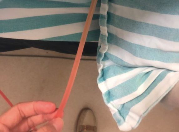 丁香病例 | 患者出现粉色尿液，你的考虑是什么？