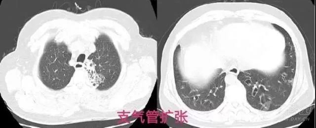 丁香病例 |  「镜面人」遇上罕见病，病情大反转