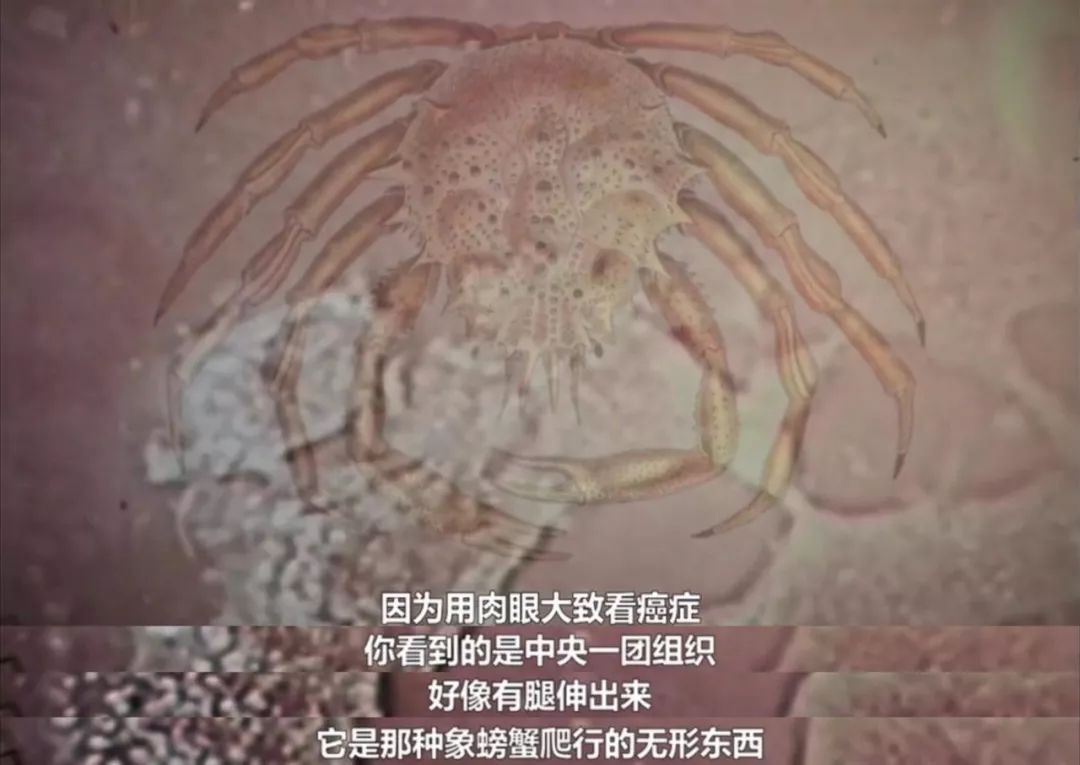 只要活得足够久，人总会患癌