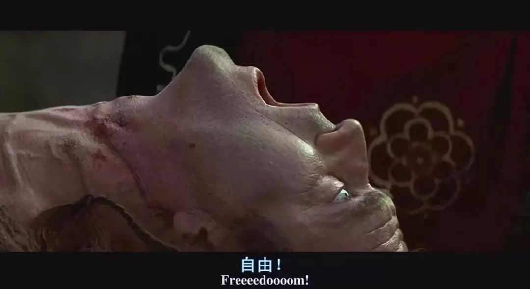 这天早上，我决定让同事把镜子伸进我的肠道