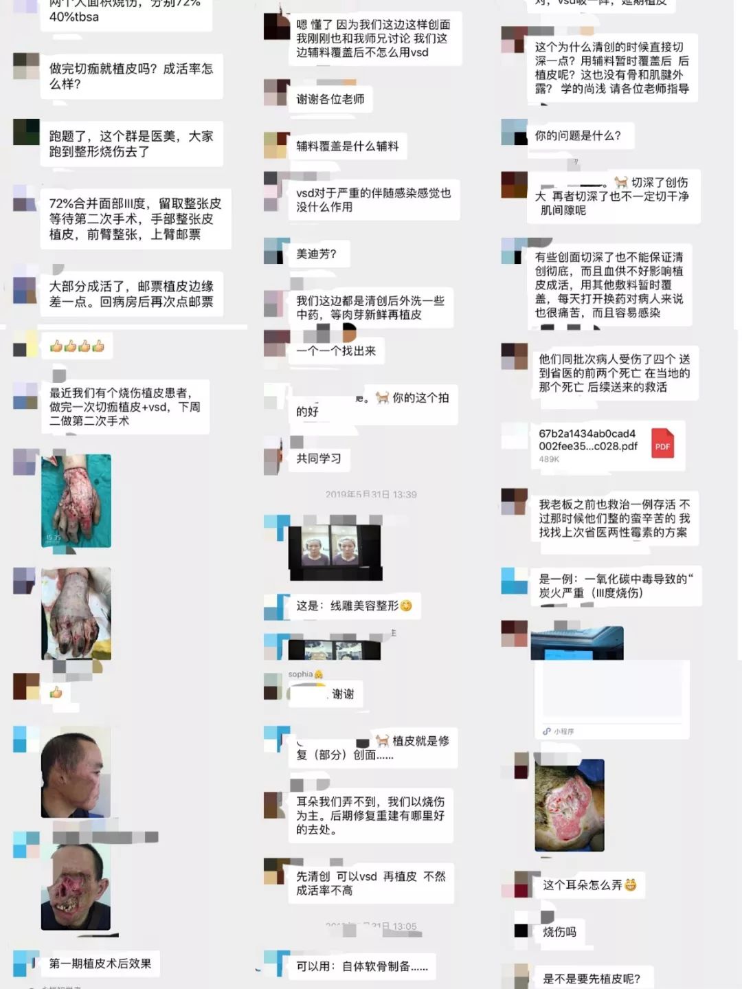 病例分享 |一例头面部皮肤撕脱伤修复治疗 病例分享 |一例头面部皮肤撕脱伤修复治疗