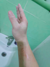 我们在非洲做手术，顺便还种了块菜地