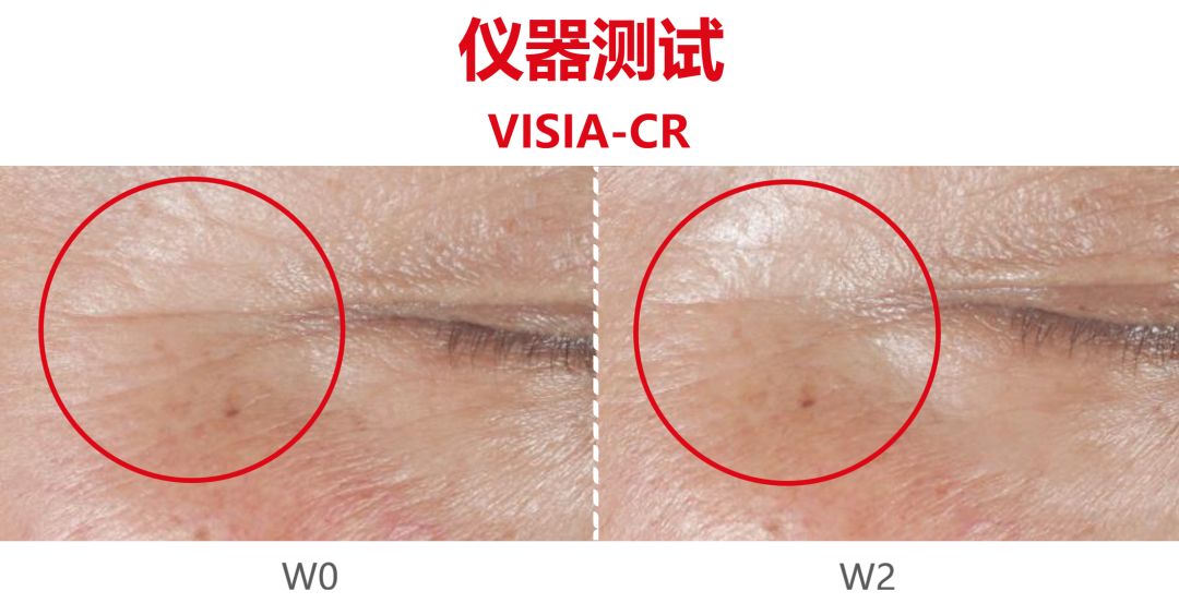 如何科学抵御缺觉、熬夜带来的苍老感？