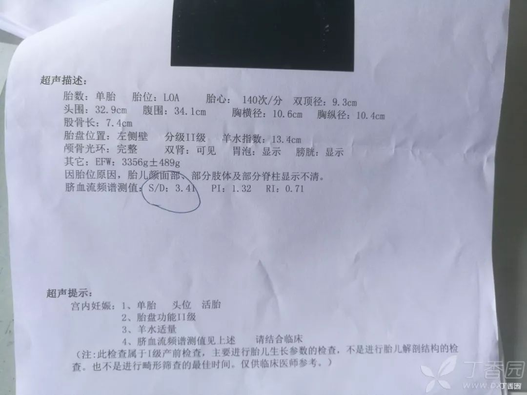 一根脐带杀死 38 周胎儿,而这次不是绕颈…… 一根脐带杀死 38 周胎儿,而这次不是绕颈……
