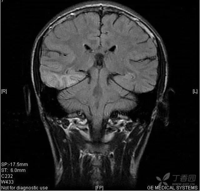 失恋患者入院，病因却在她男友身上找到了