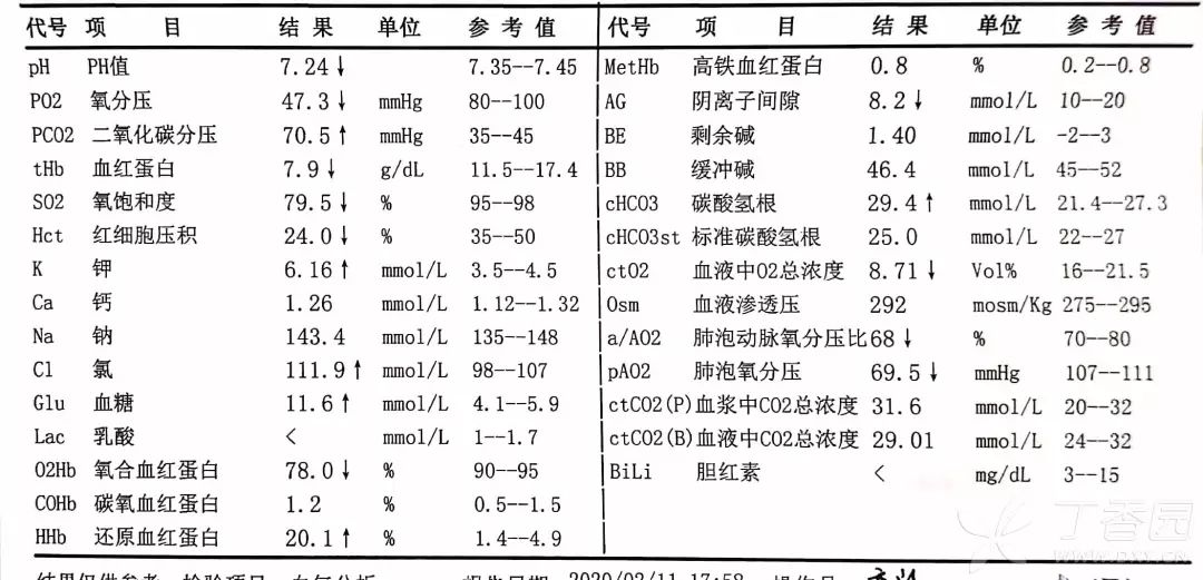 被动急性二氧化碳中毒的阿姨 | 丁香病例