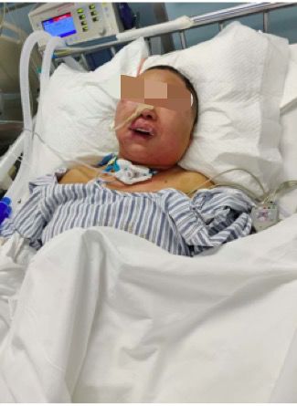 九死一生的车祸患者，疫情下的劫后余生