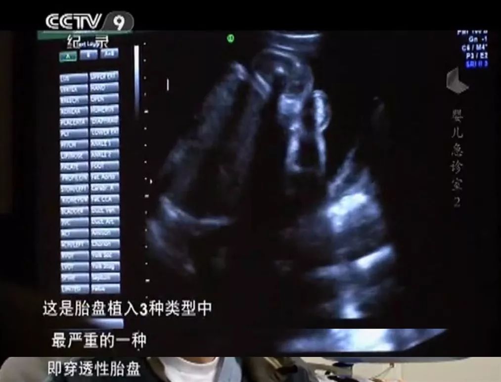 在婴儿急诊室里，一起迎接世界给的第一个考验