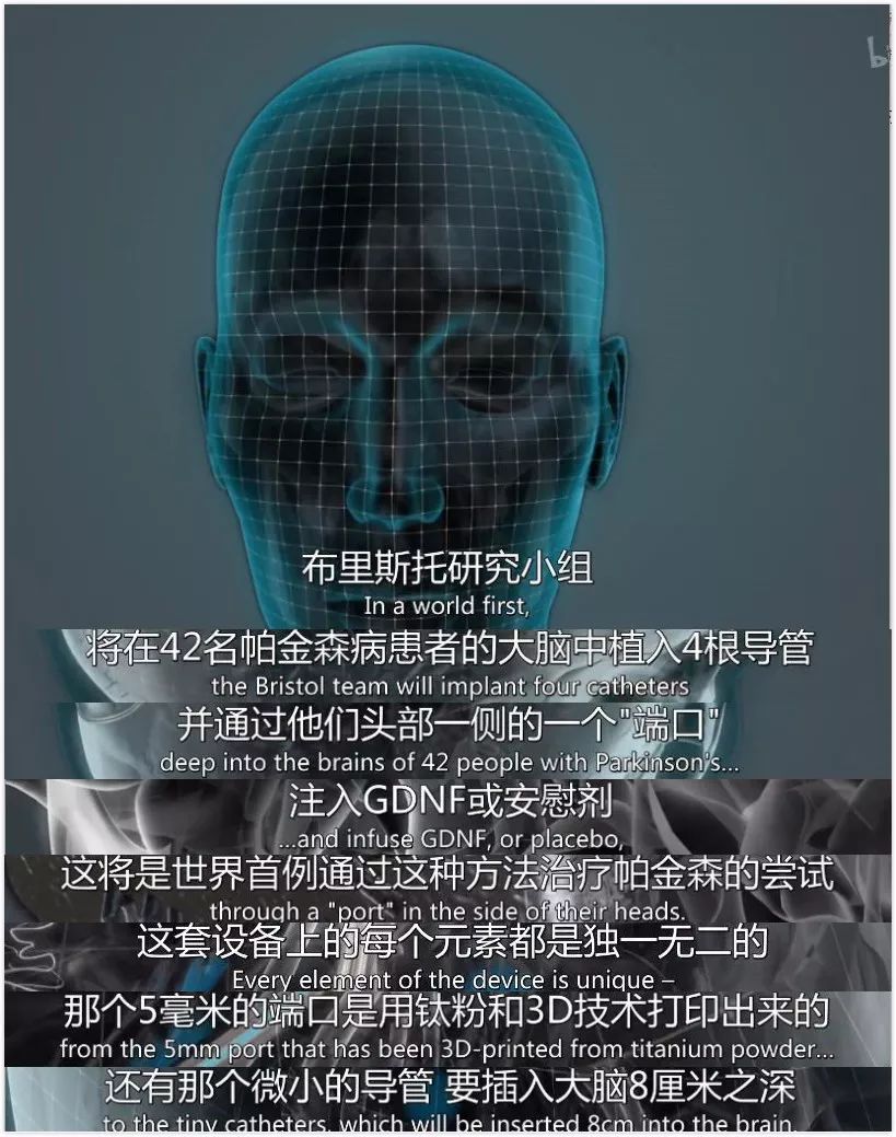历时 6 年，无法站立的他终于可以自由奔跑