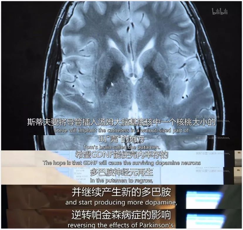 历时 6 年，无法站立的他终于可以自由奔跑