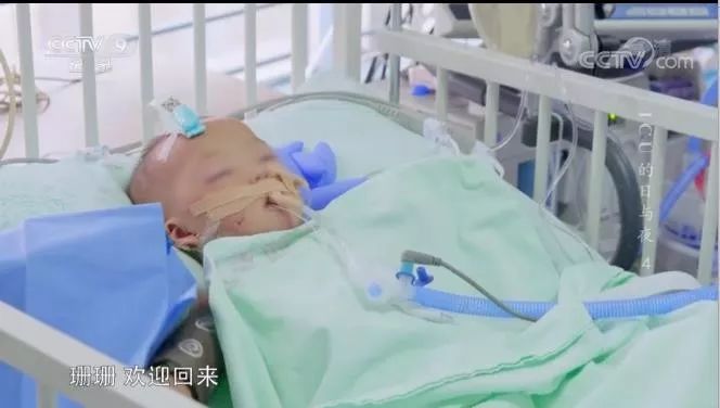 ICU 里的日与夜