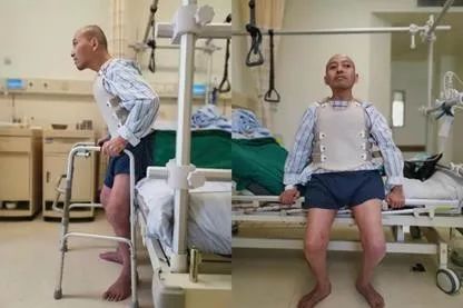 4 次马拉松式的手术，打开了他 28 年的折叠人生