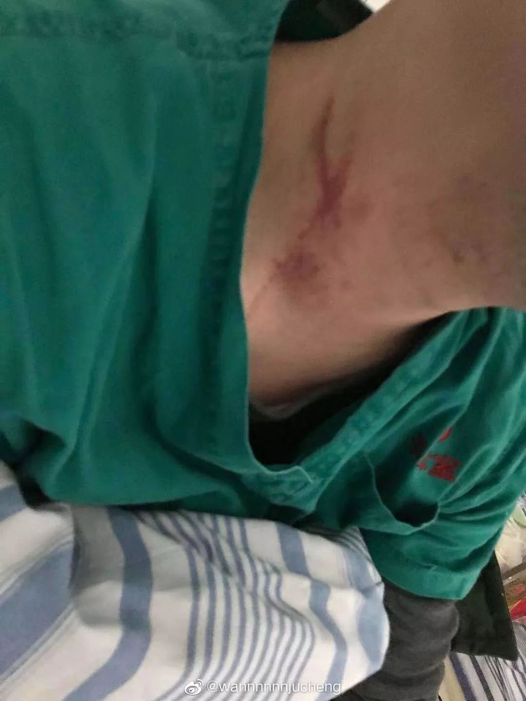 武汉 2 名一线医生被患者家属殴打 | 附当事医生自述