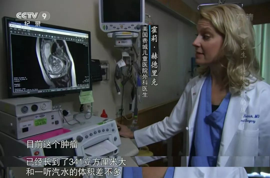 她第一次接受手术，是在妈妈的肚子里