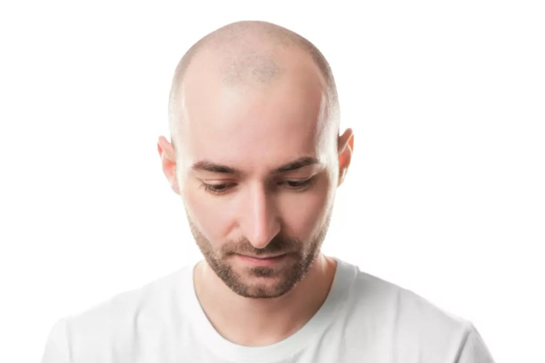当年曾经的翩翩少年，如今已是脑瓜锃亮，医生秃顶了算工伤吗？