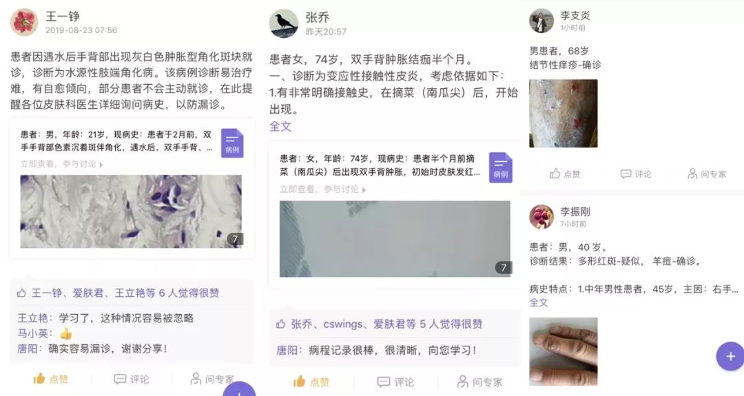 28 岁女子足底红斑久治不愈，追问病史，原因竟然是......