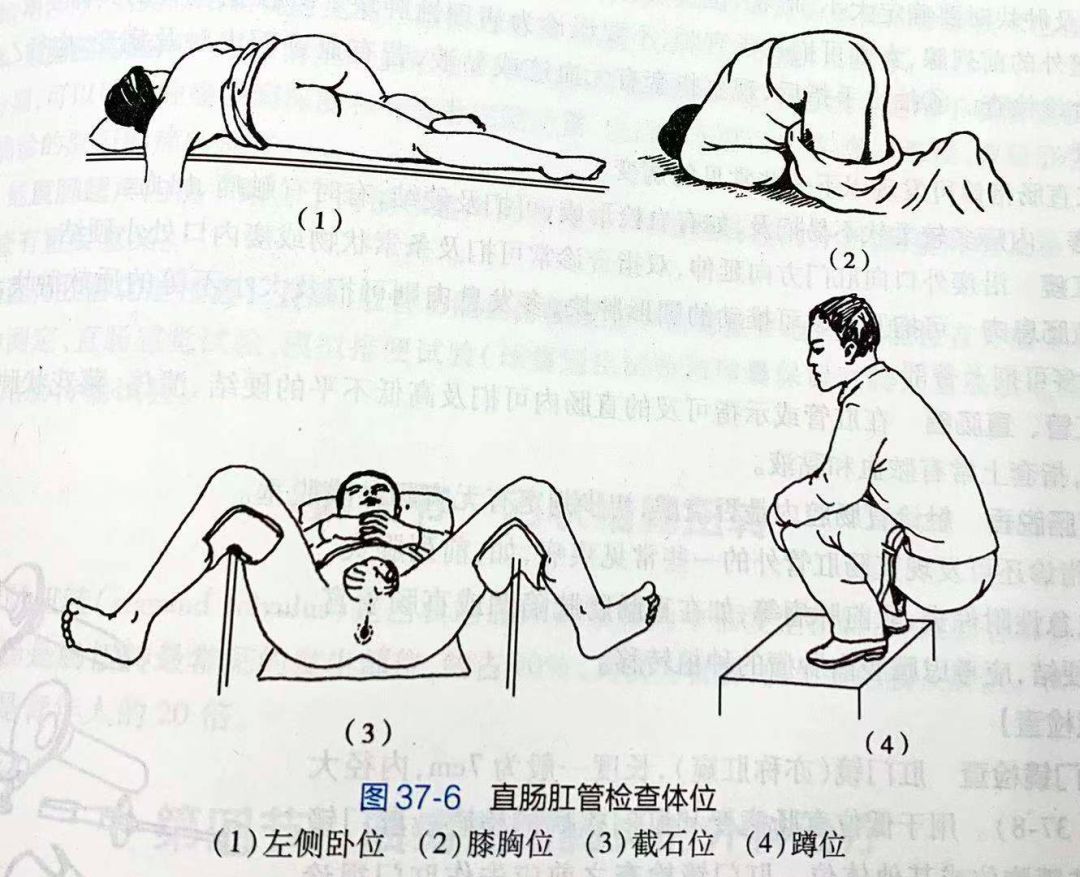 这天早上，我决定让同事把镜子伸进我的肠道