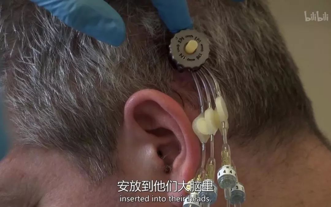 历时 6 年，无法站立的他终于可以自由奔跑