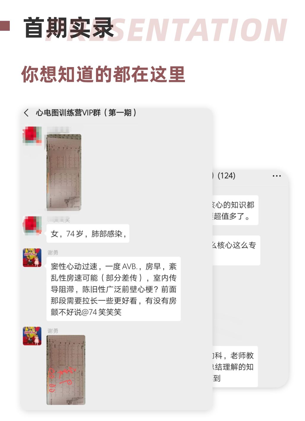 不靠死记硬背？心电图到底应该怎么学