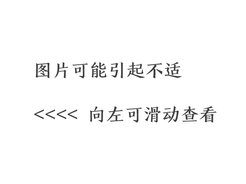 40 岁女性受凉后右上肢大面积脱皮,12 天后死亡 40 岁女性受凉后右上肢大面积脱皮,12 天后死亡