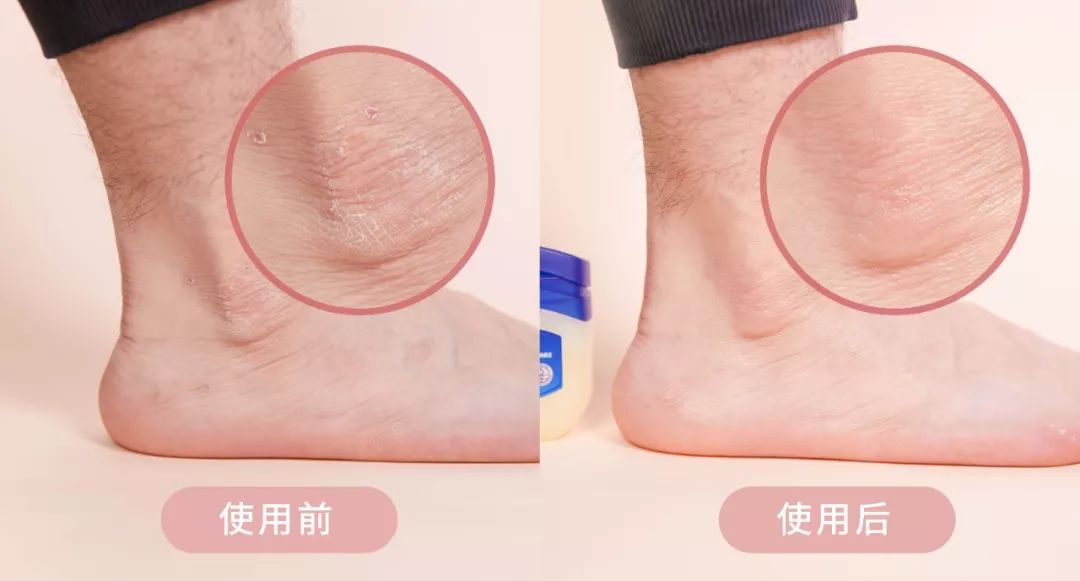 想要肌肤嫩滑?你得补「油」了 想要肌肤嫩滑?你得补「油」了