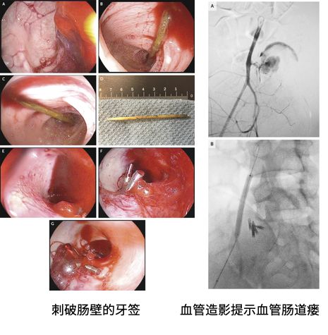 同样是病例,同行早就整理好发在 NEJM 上! 同样是病例,同行早就整理好发在 NEJM 上!