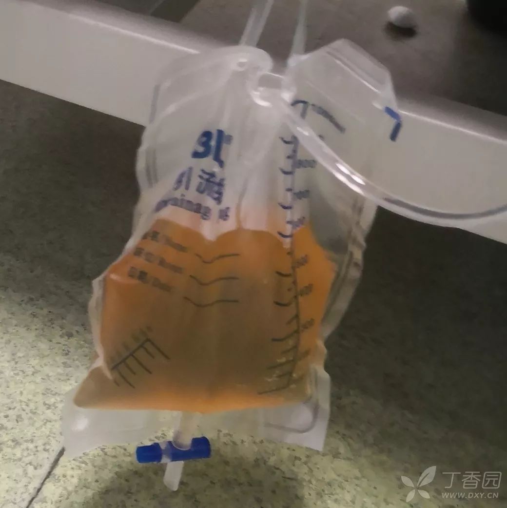 吃药后昏迷 2 小时,全身酸痛的男人! | 丁香病例 吃药后昏迷 2 小时,全身酸痛的男人! | 丁香病例