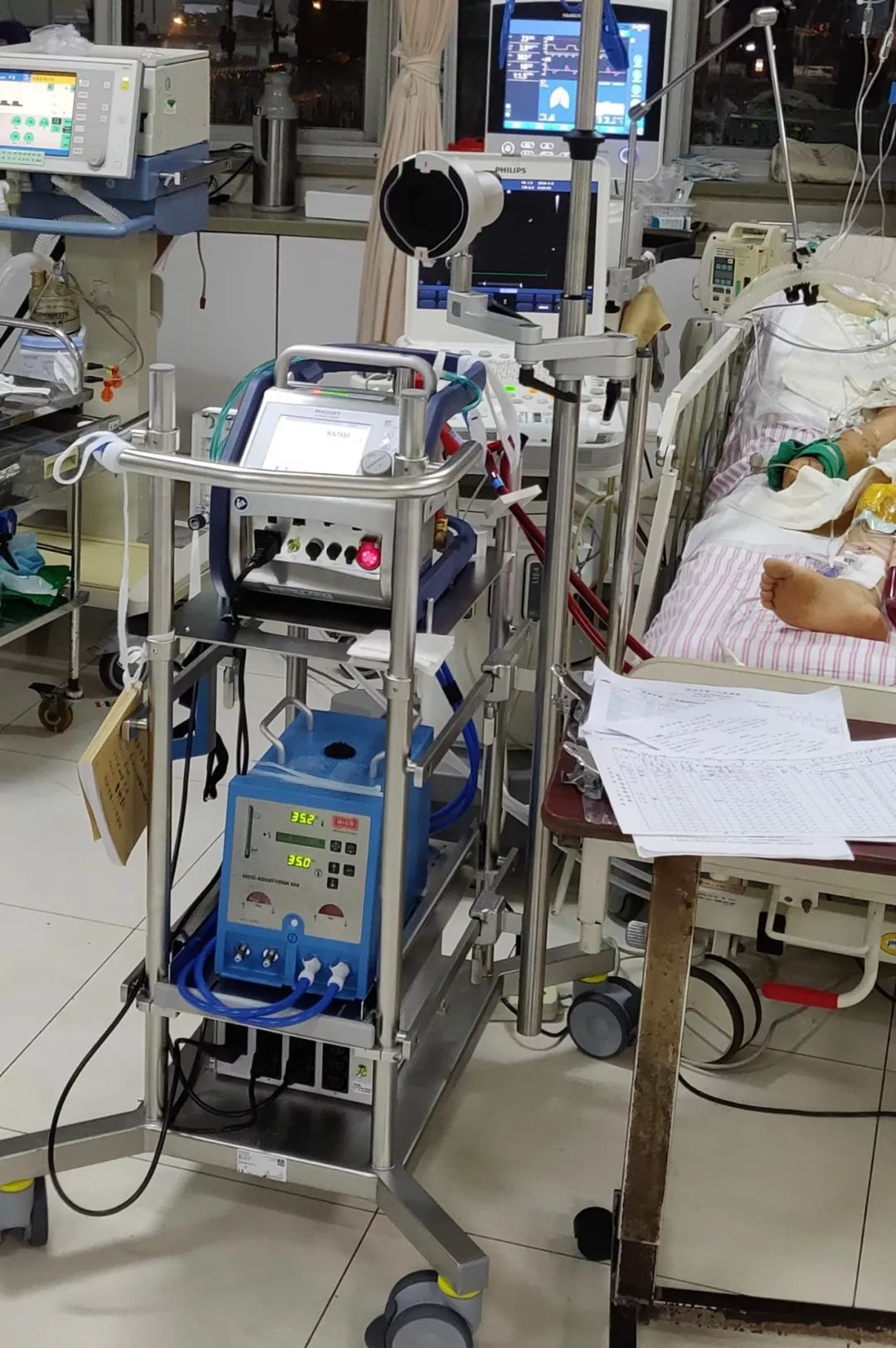 ECMO：医生救人，就只是让人一直「活着」吗？