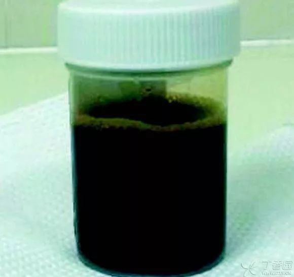 纯黑色液体的胸腔积液，这个患者怎么了？| 丁香病例