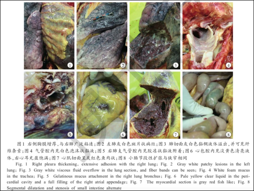 首例新冠尸检报告发布气道大量黏稠分泌物主要引起远端肺泡损伤