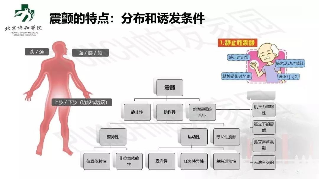 手抖就是帕金森病吗？临床常见的 4 个误区